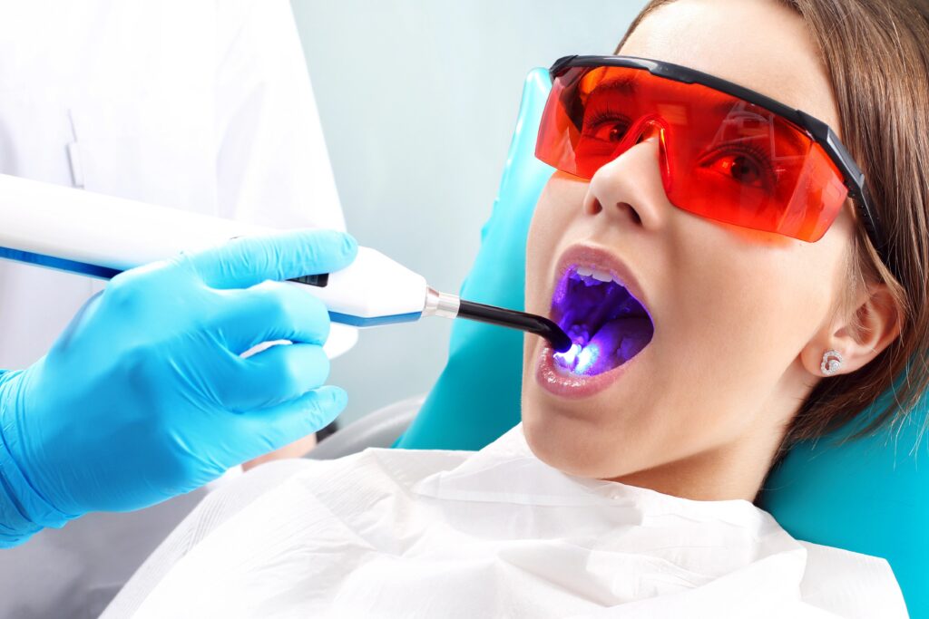 Teeth Bonding at Oakwood Dental and Implants